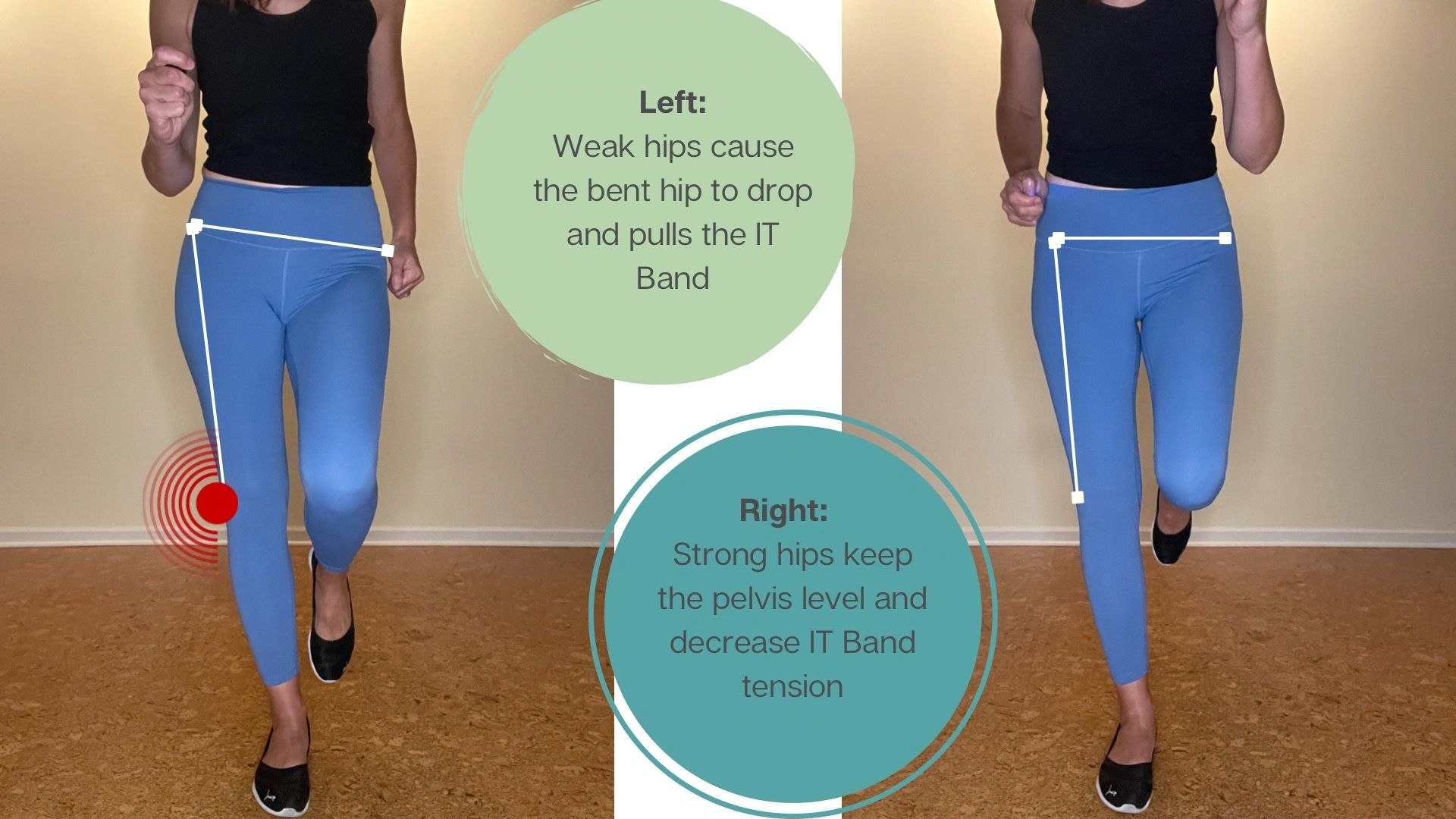 Hip Weakness may increase IT Band tightness